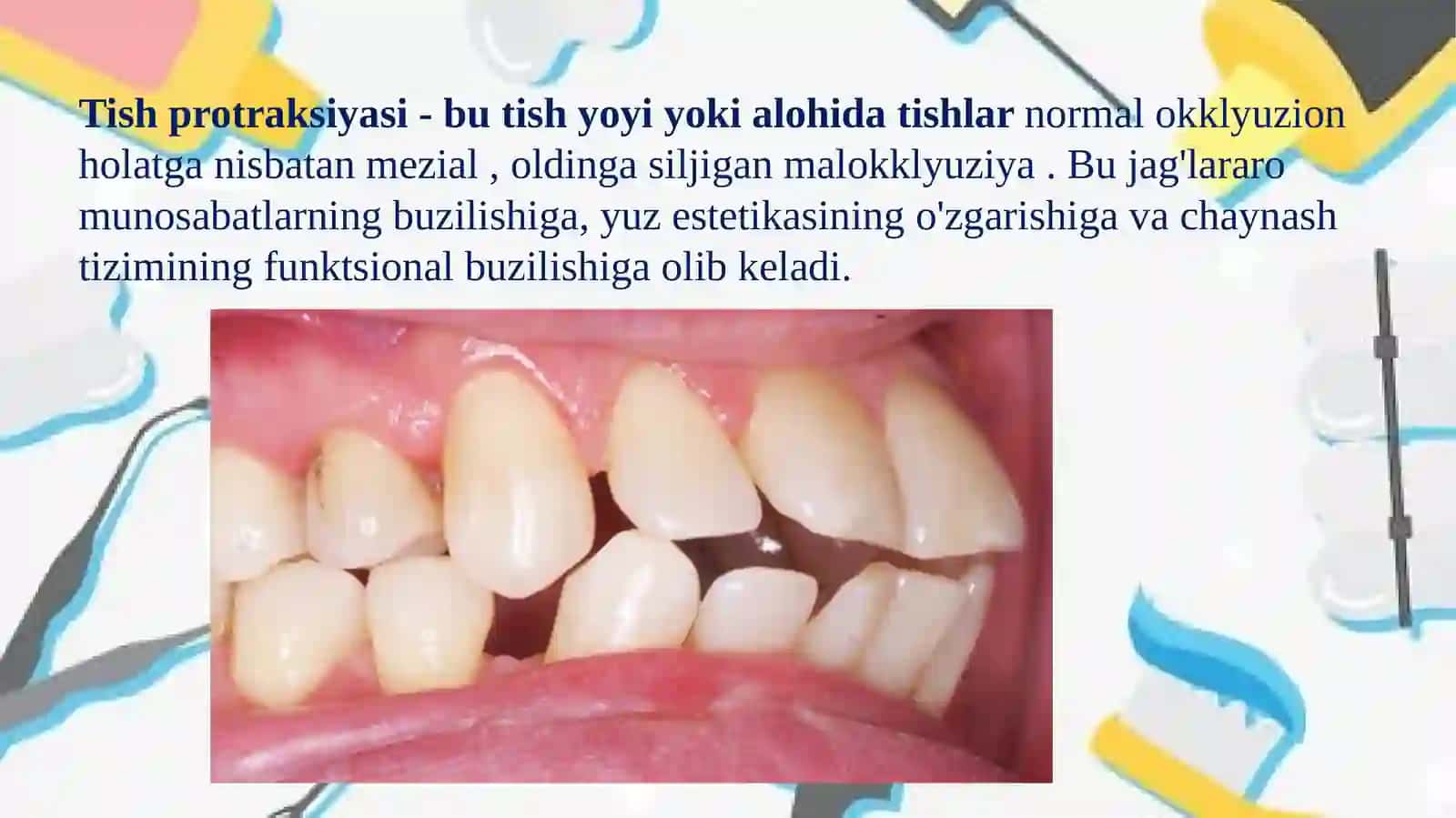 Tish qatorlarning protraksiyasi 3