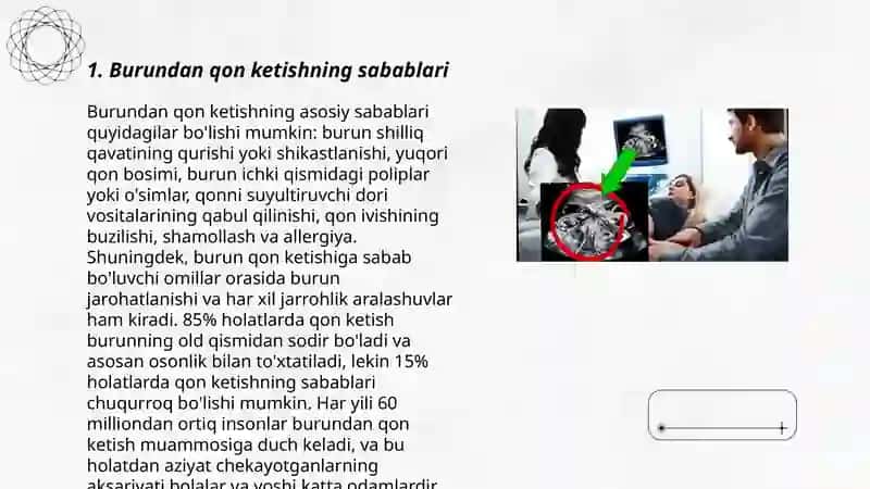 Burundan qon ketish etiologiyasi, klinikasi, tashxislash va davosi 3