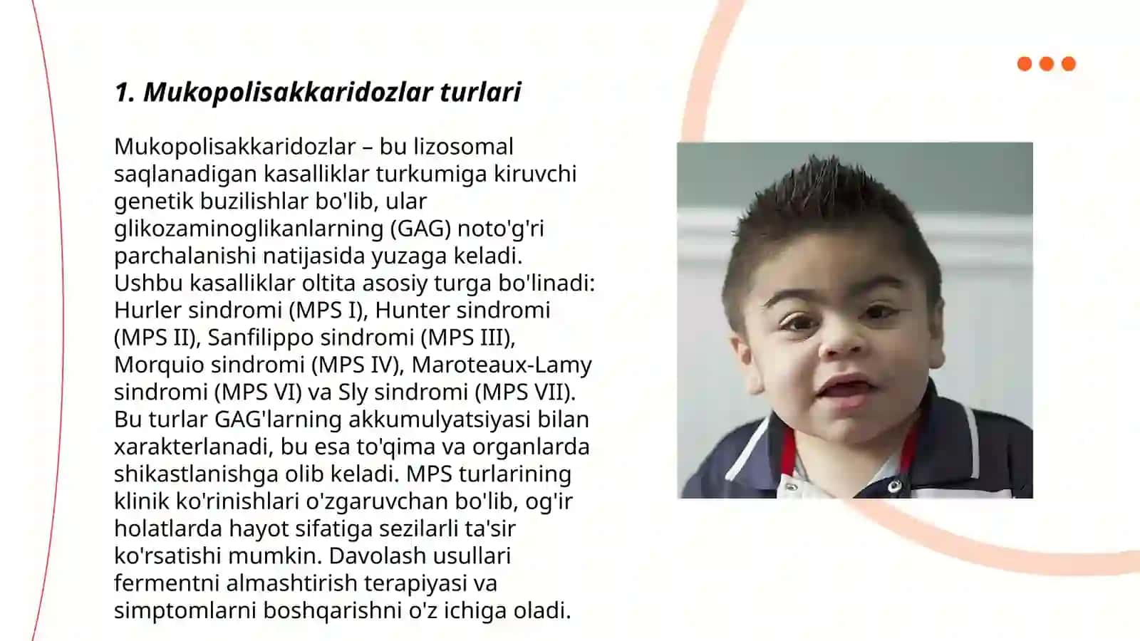 Mukopolisakkaridozlar 3