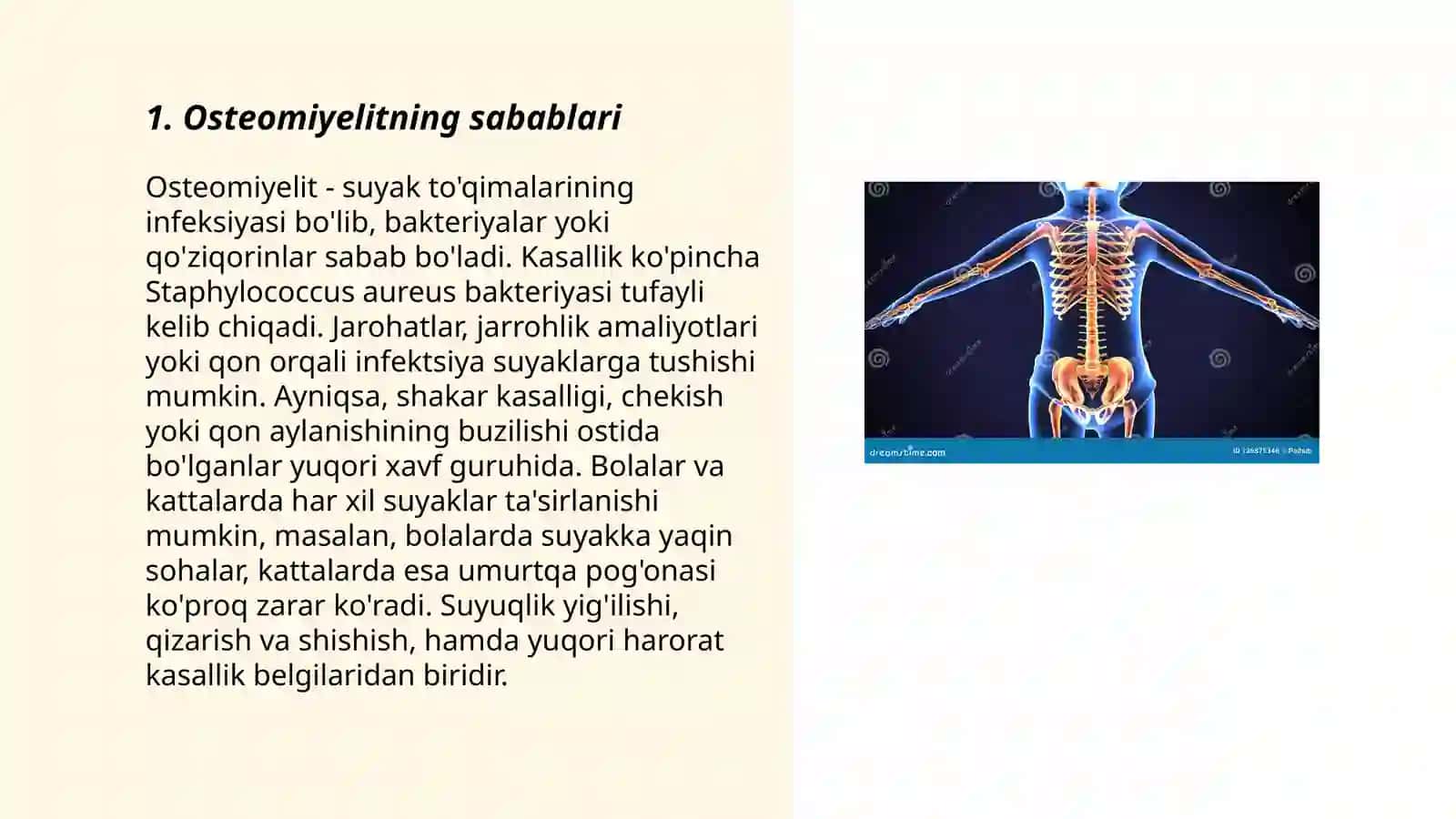 Osteomiyelit 3