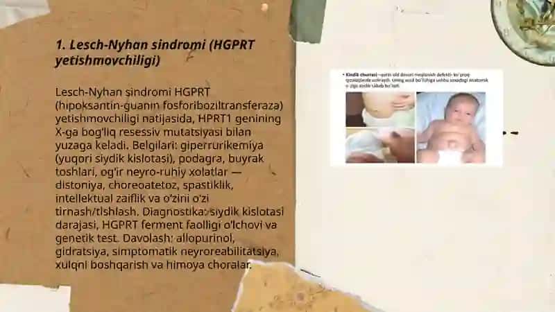Purin va pirimidin almashinuvining buzilishi bilan bog'liq bo'lgan kasalliklar 3