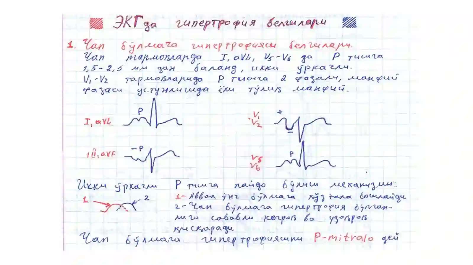 Koronar tomir yetishmovchiligidagi EKG belgilari 3
