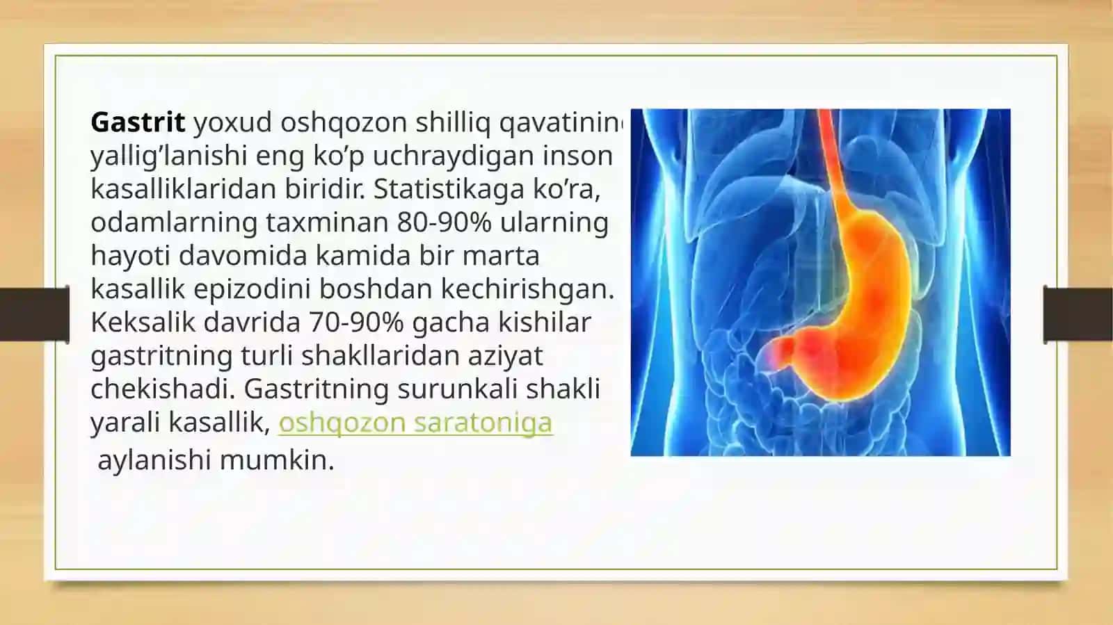 Oʻtkir va surunkali gastritlar klinik kechishi, diagnostik 
kriteriyalari. 3