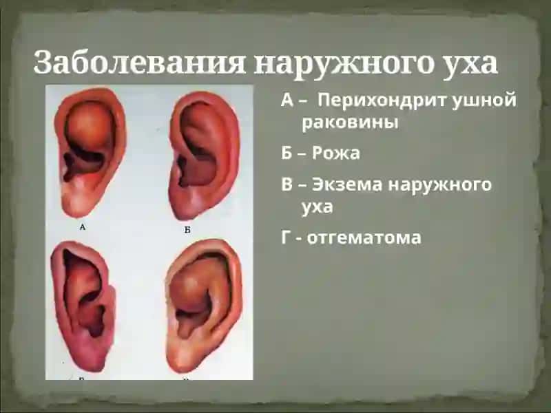 Острые и хронические воспалительные 3