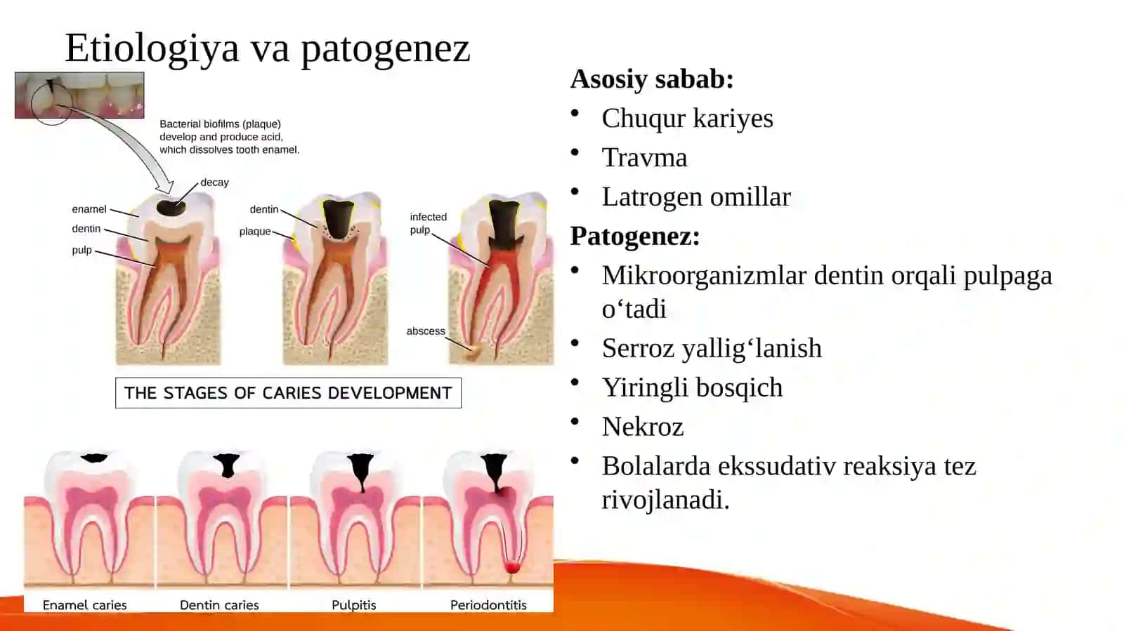 Bolalarda o‘tkir va surunkali pulpitlarning o‘ziga xos klinik xususiyatlari va tashxisi. 3