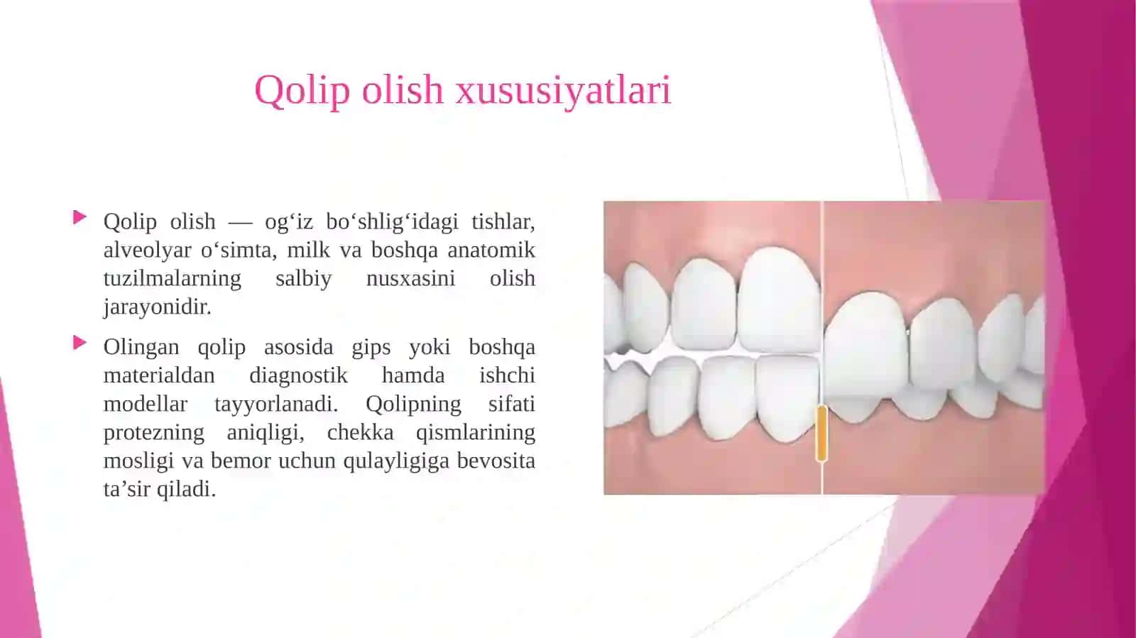Qolip olish xususiyatlari. Milk buramalari morfologiyasi, milk cho'ntagi atamasi. Milk burmalarini ochish usullari, hosil bo'lgan ustupni silliqlash. Ikki qavatli qolip olish usullari. 3