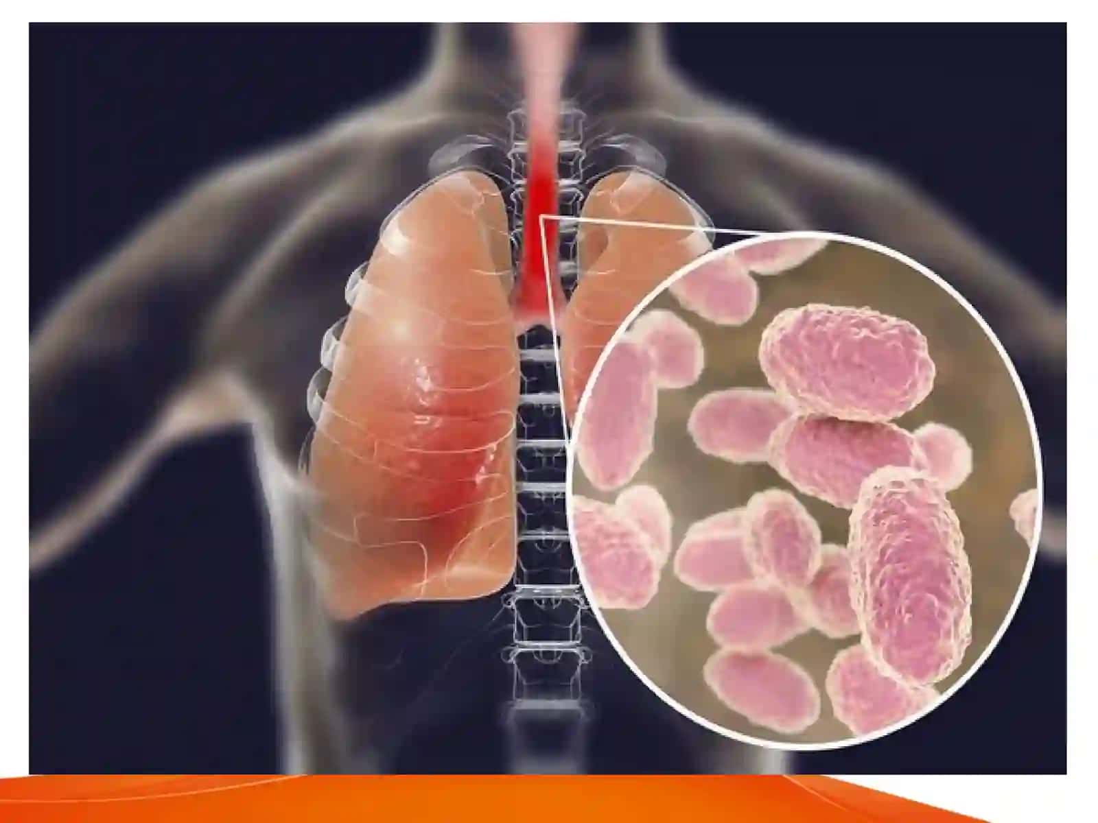 BAKTERIYALARNING ANTIBIOTIKLARGA CHIDAMLI SHAKLLARINI PAYDO BO`LISH MEXANIZMLARI 3