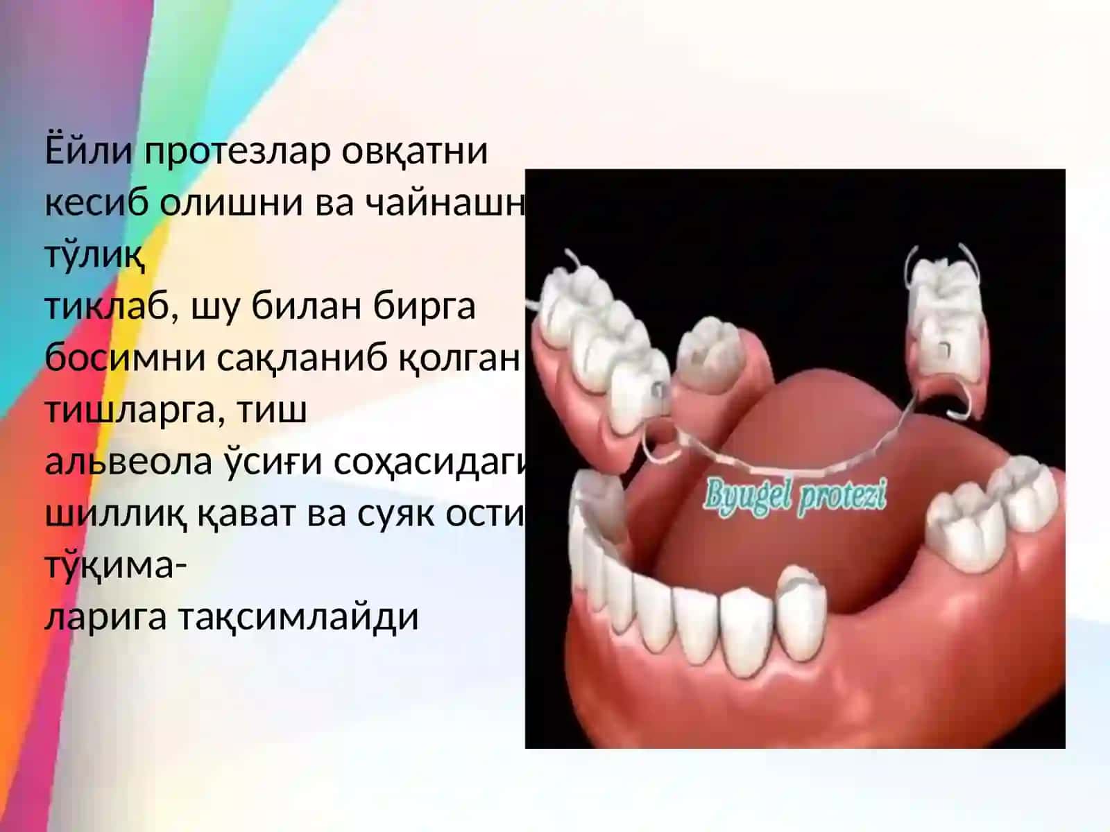 Ёйли протезлар 3