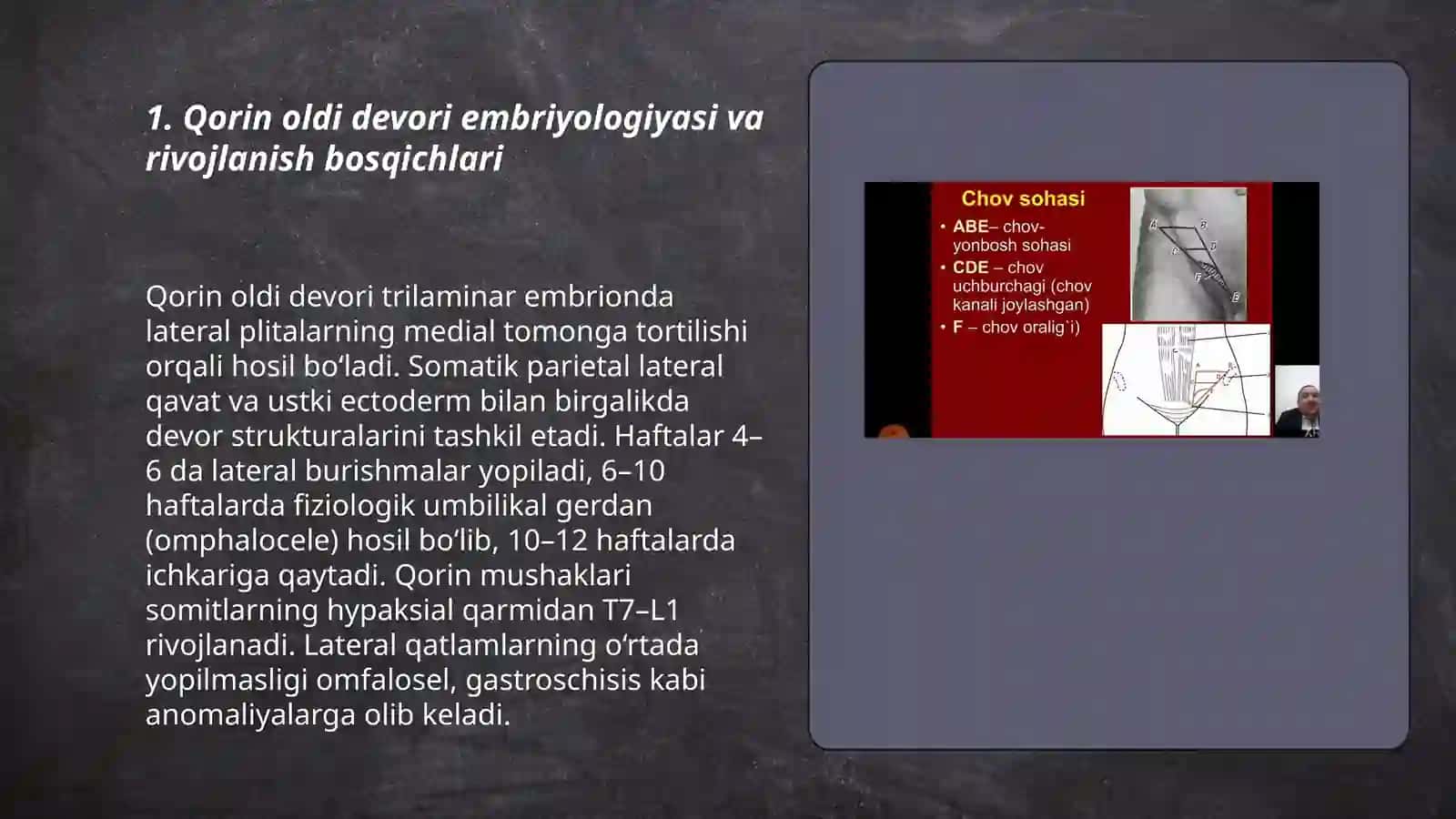 Qorin oldi devorining rivojlanish nuqsonlari va anomaliyalari tasnifi 3