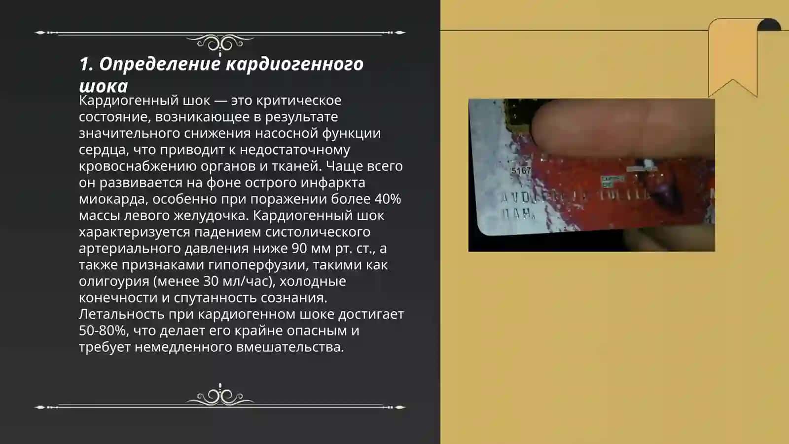 Кардиоген шоква 3