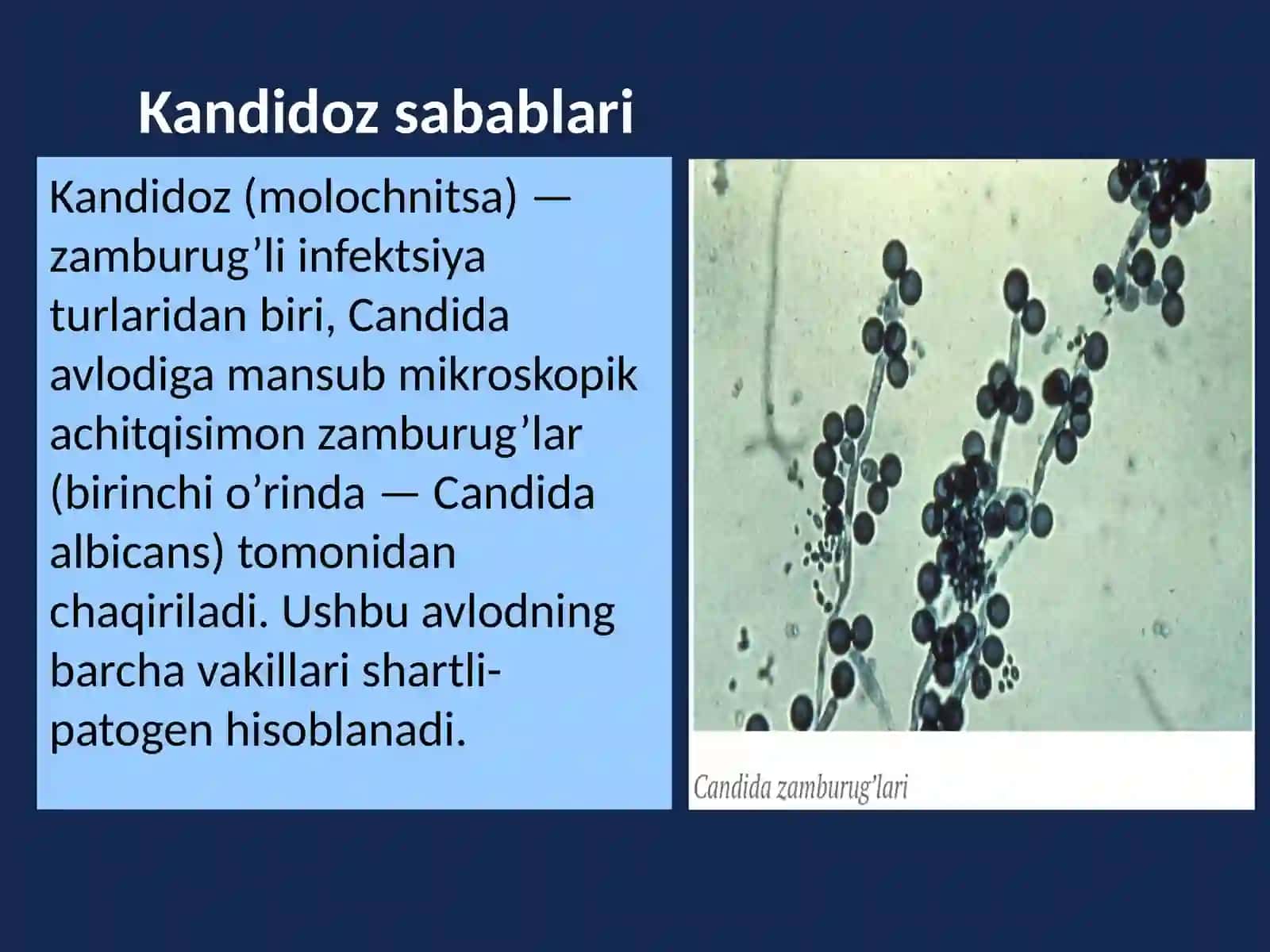 Zamburug‘ infeksiyalari (Kandidoz, Aspergillez) 3