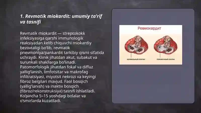 Revmatik miokardit 3