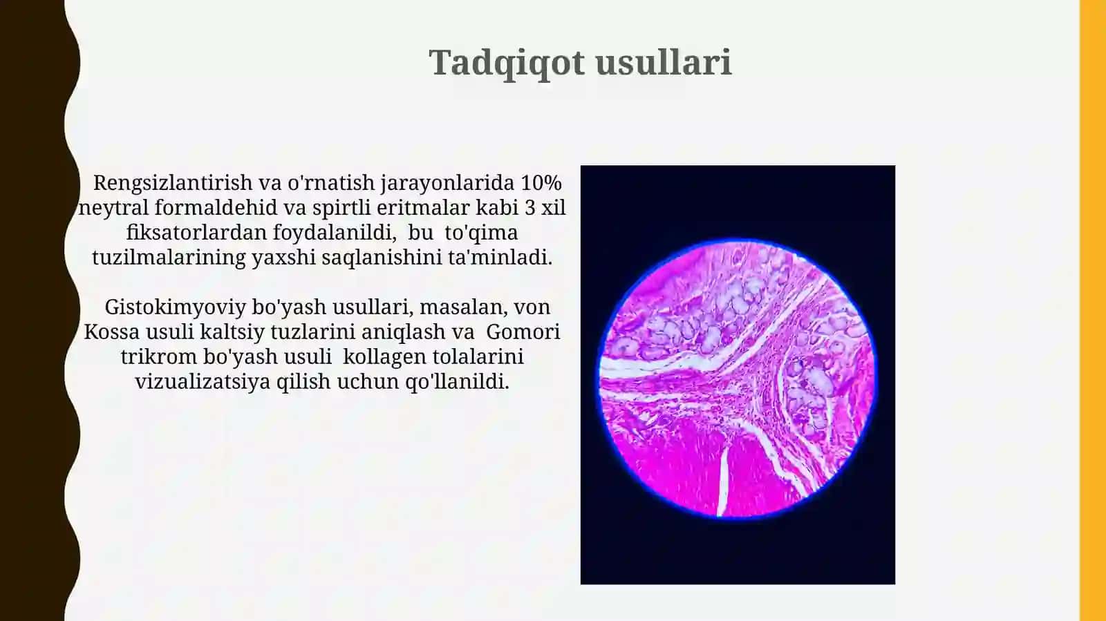 Tish qattiq toʻqimalarining (emal dentin sement )gistologik tuzulishi 3