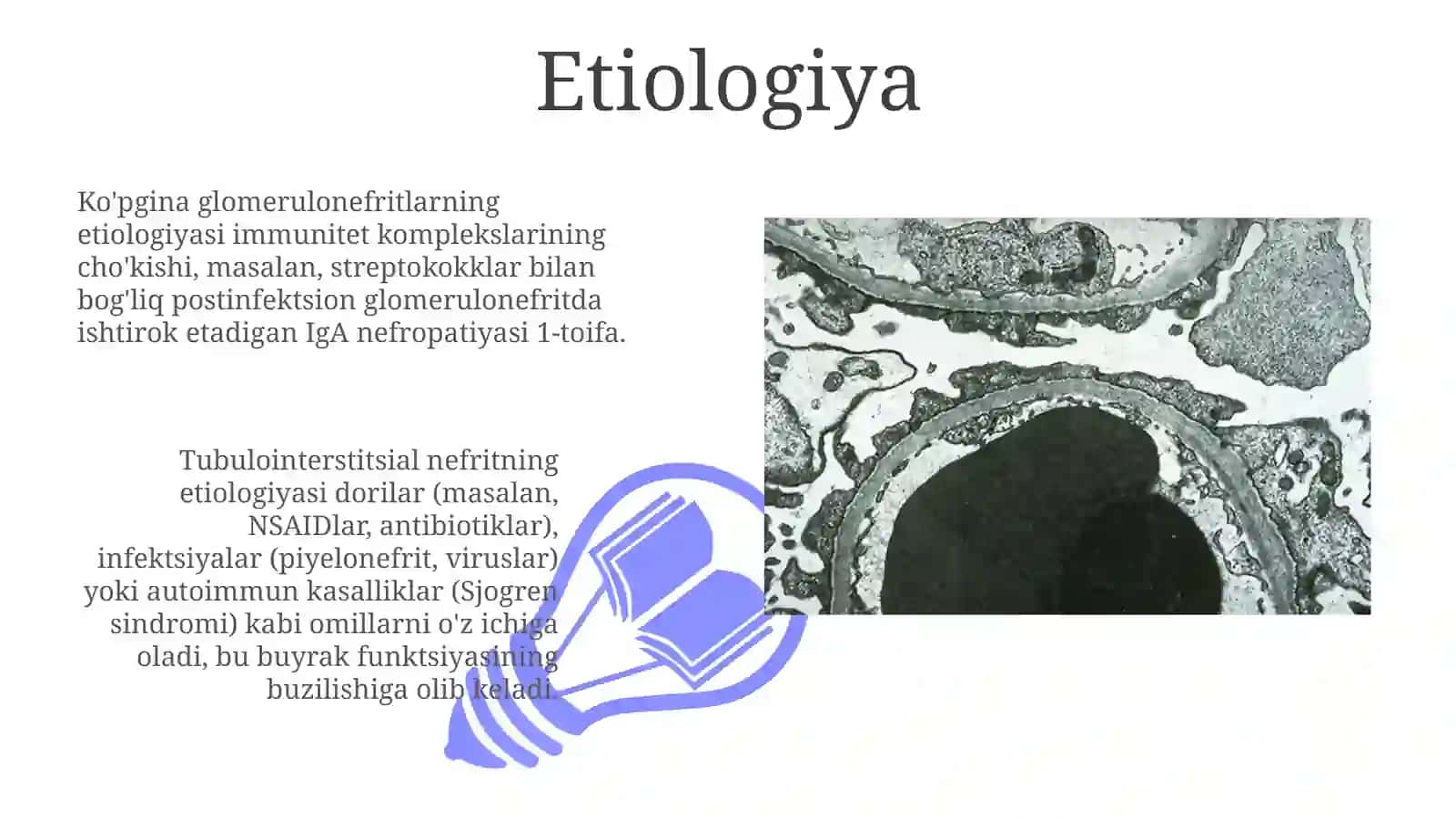 Buyrakning yallig'lanish kasalliklarining etiologiyasi, patogenezi, kasallik 3
