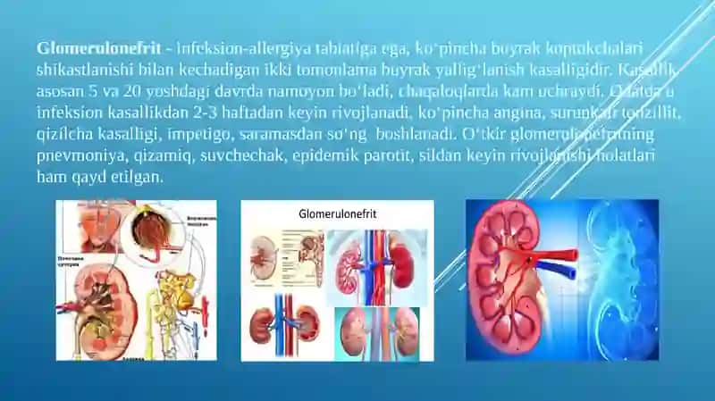 GLOMERULONEFRITLAR 3