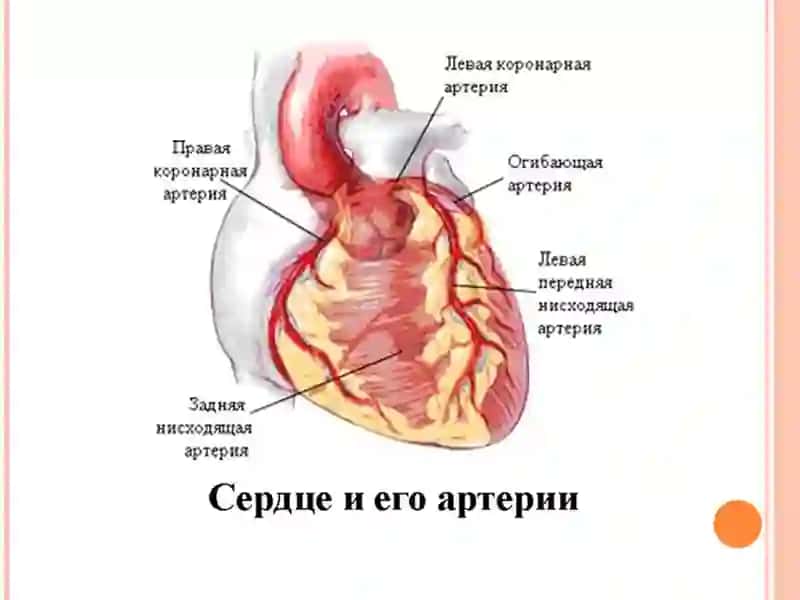 Миокард инфаркти 3