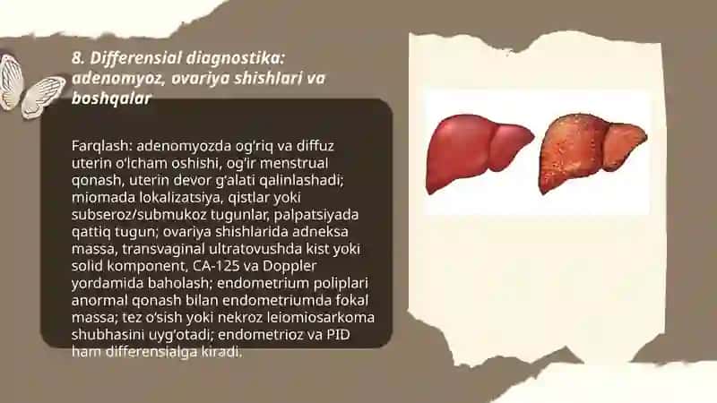 Terapiya jigar serroz 3