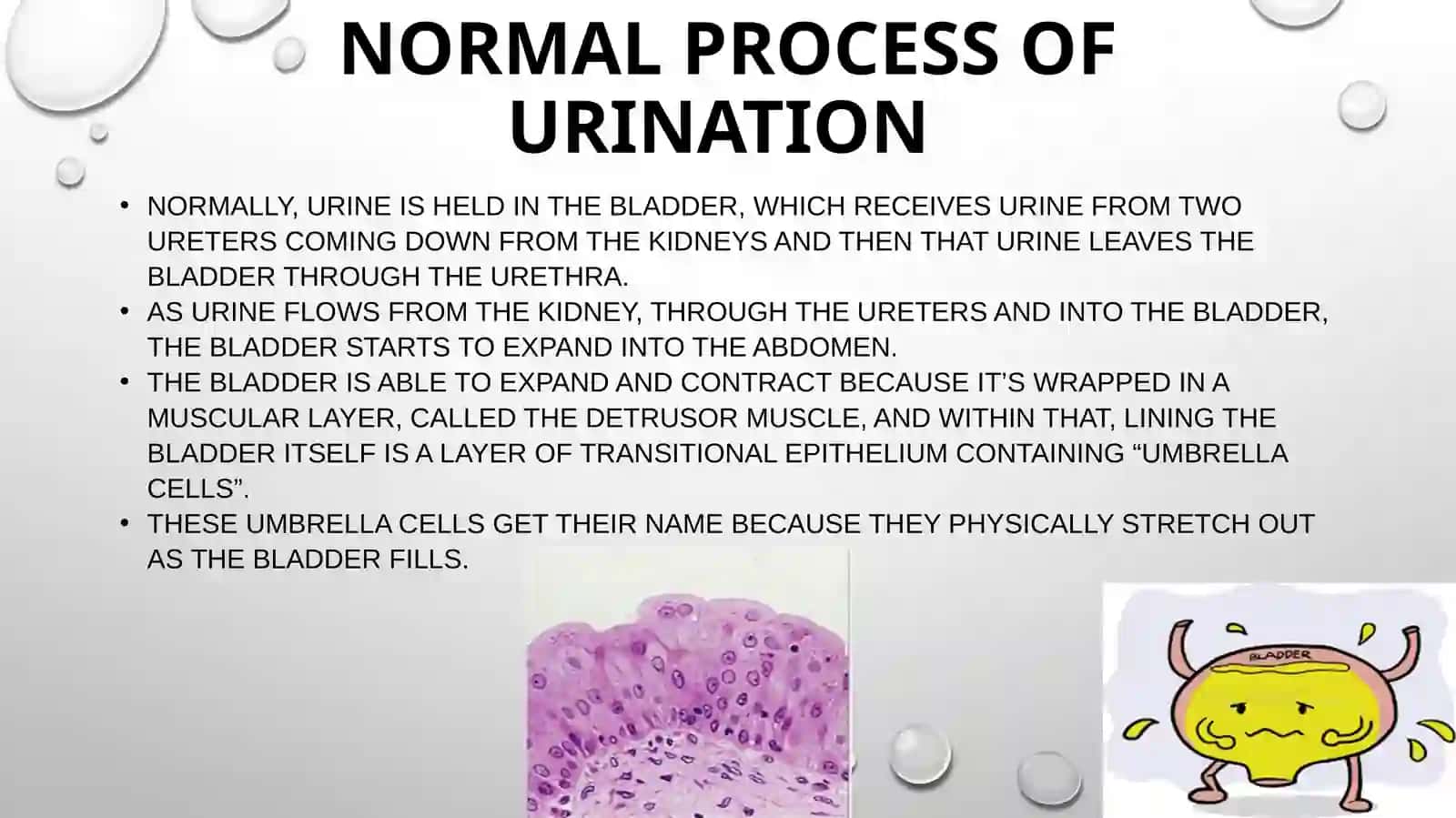 URINARY INCONTINANCE 3