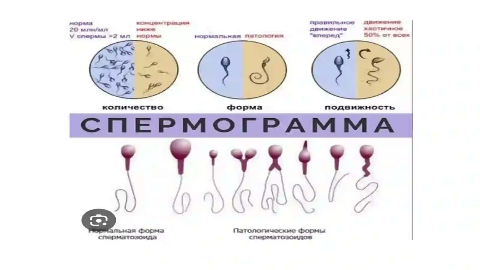 SPERMAGRAMMA 3
