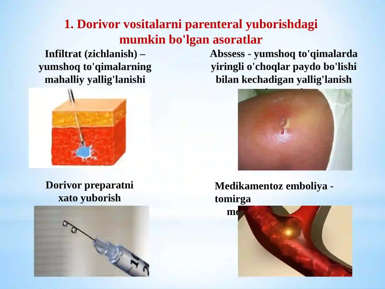 Dori vositalarini parenteral yuborishdagi asoratlar 3