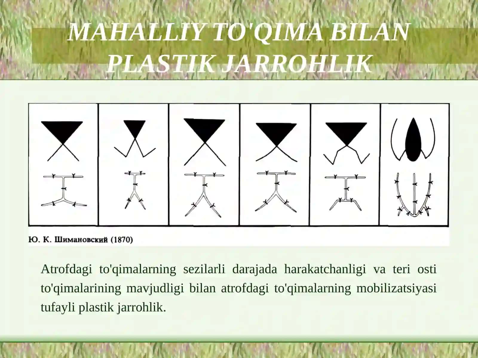 Mahalliy to‘qimalar bilan plastika qilish: Limberg uchrashuvchi uchburchakli laxtaklar. Ko’rsatmalar. Turlari va o‘tkazish prinsiplari. 3
