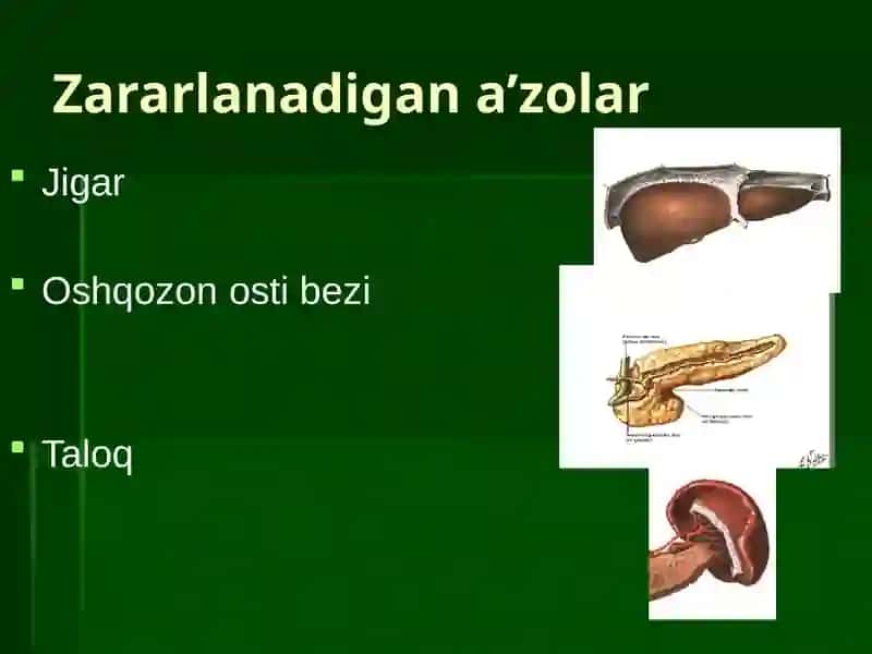 QORIN BO’SHLIG’I AZOLARINING YOPIQ SHIKASTLANISHLARI 3