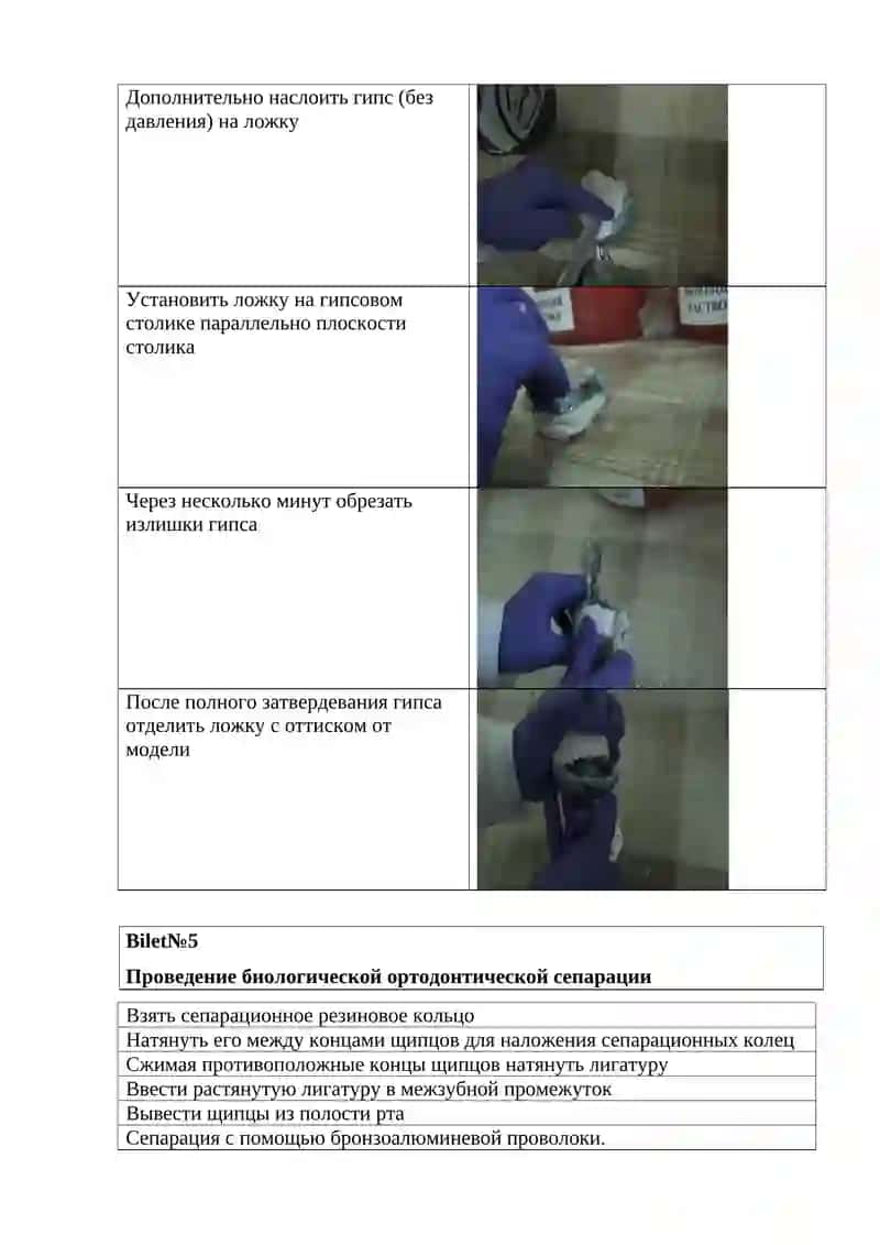 Снятие оттиска эластичной массой 3
