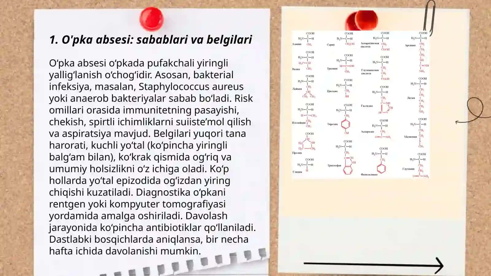 O'pka apsesi quriq va eksudatlik plevratlarda hamshiralik ishi 3