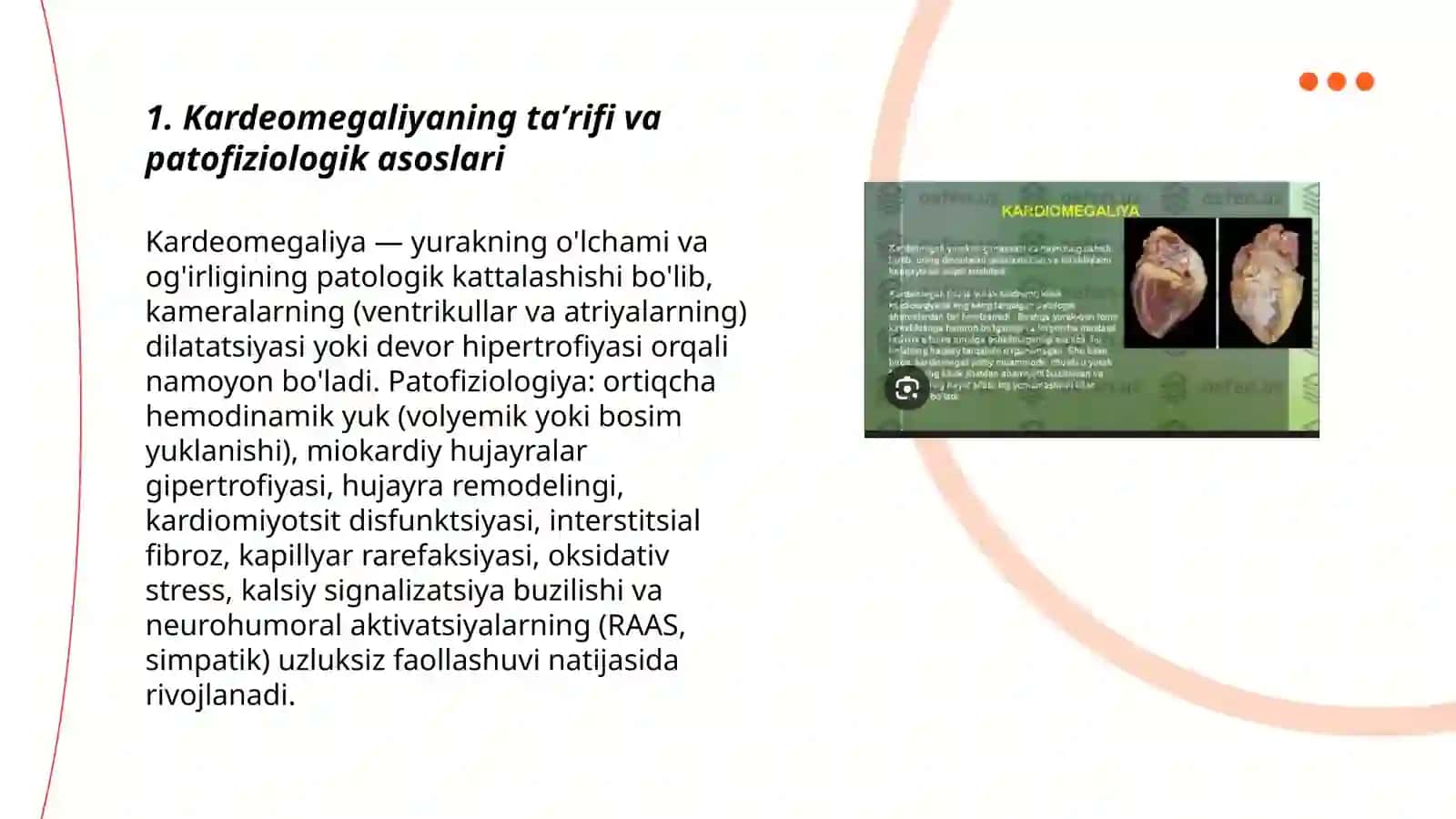 Kardiomegaliya 3