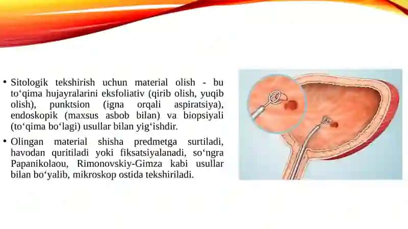 Sitologik tekshirish uchun materialni olish usullari:eksfoliativ, punktsion, endoskopik, biopsiyali. Sitologik surtma tayyorlash, bo'yash usullari. 3