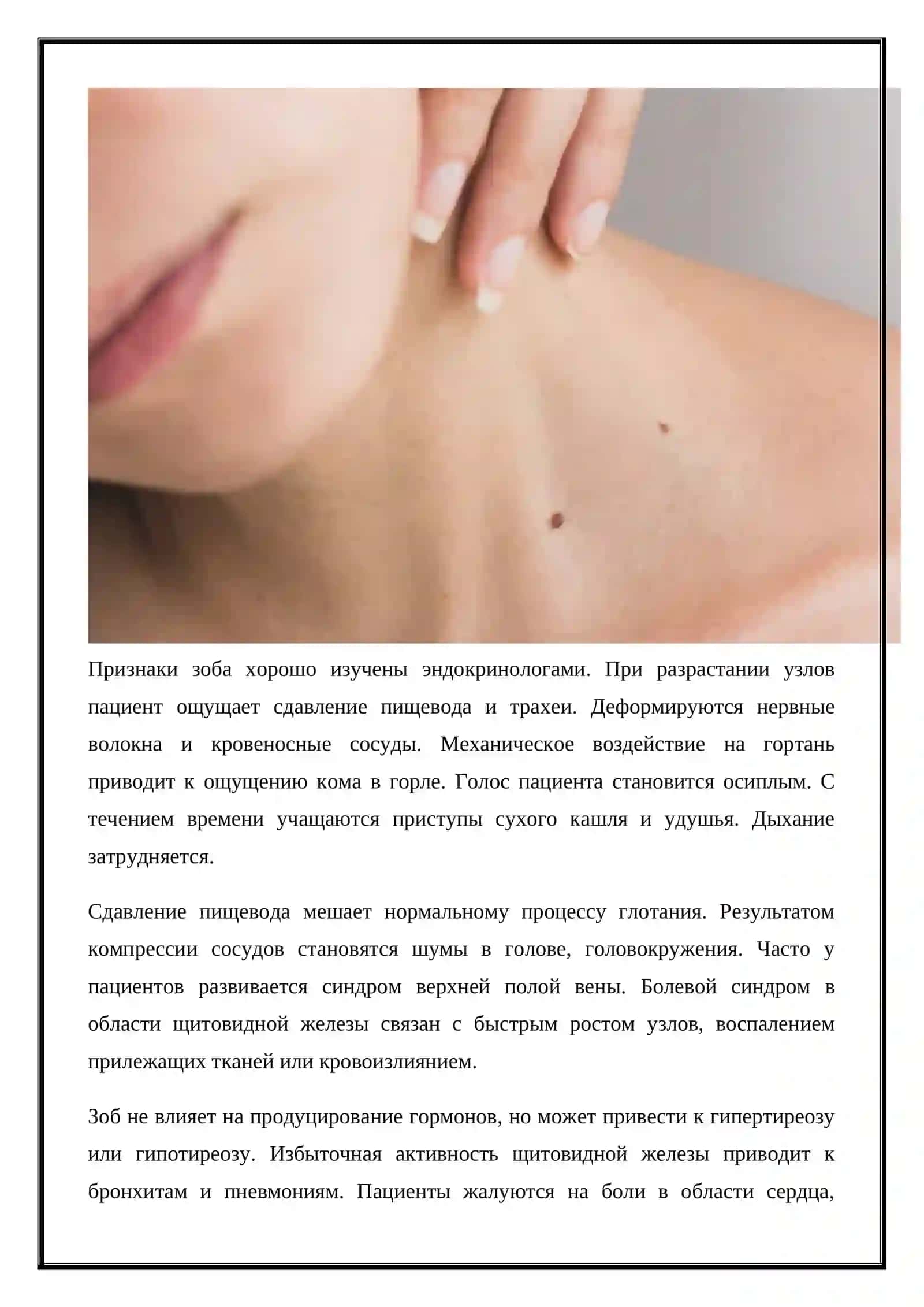 Диагностика и лечение клинических симптомов зоба 3