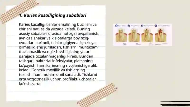 Karies kasalligi 3
