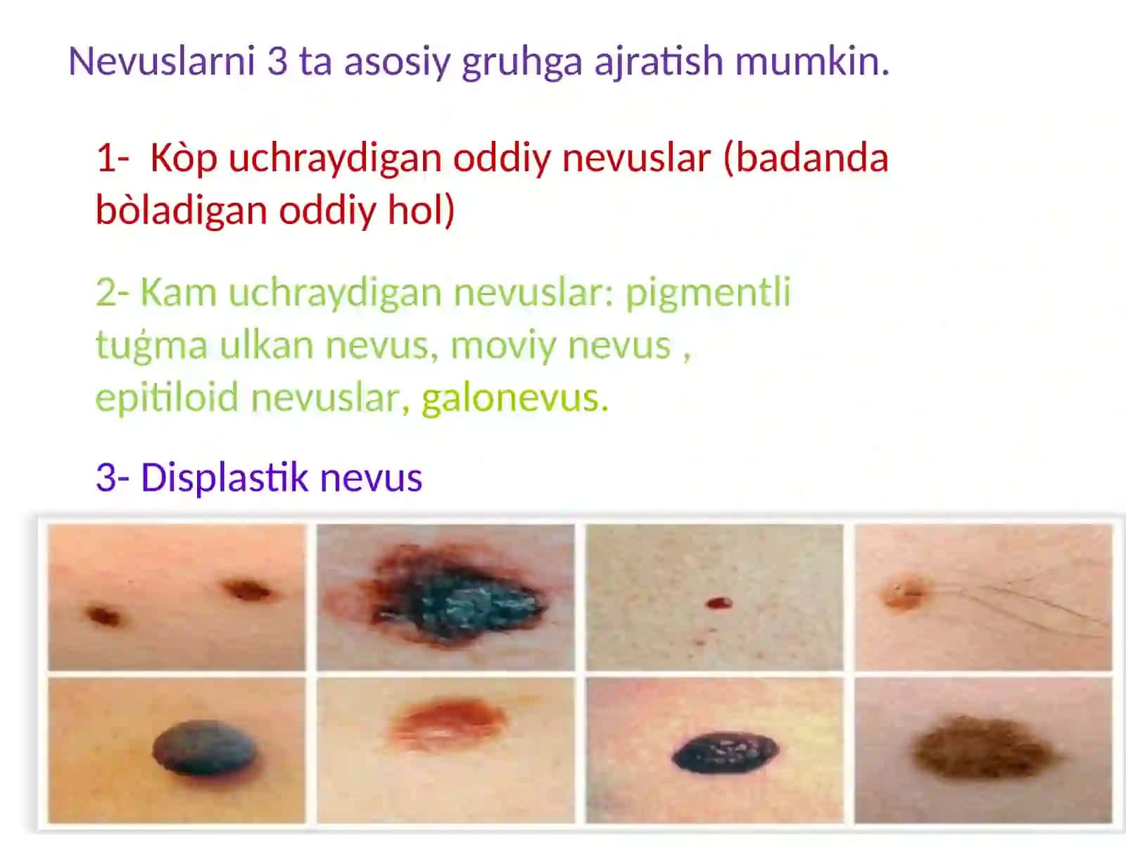 NEVUSLAR 3