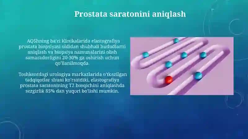 Elastografiya asoslari 3