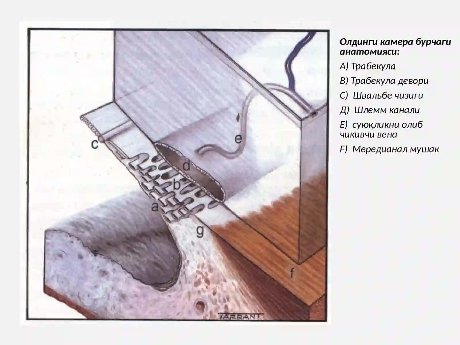 Глаукома 3