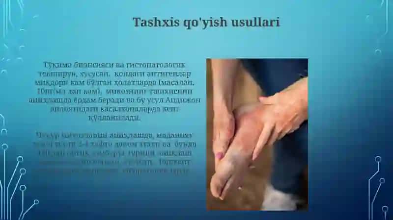Chuqur mikozlar 3