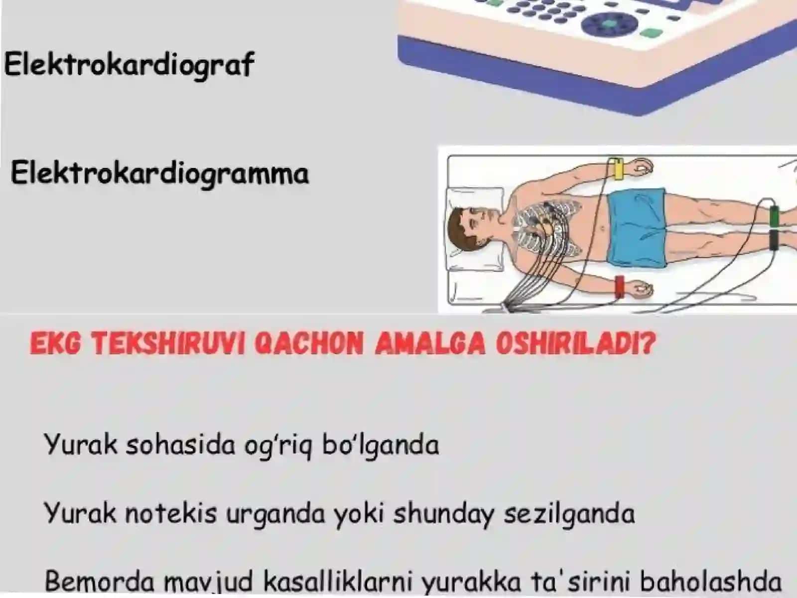 Chaqaloqlarda EKG ning o'ziga xos xususiyatlari 3