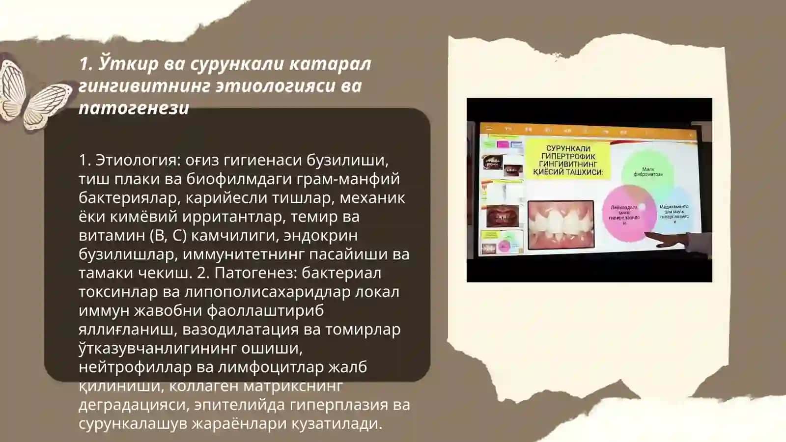 Ўткир ва сурункали катарал гингивит асоратлар, уларнинг профилактикаси ва давоси режасини тузиш 3