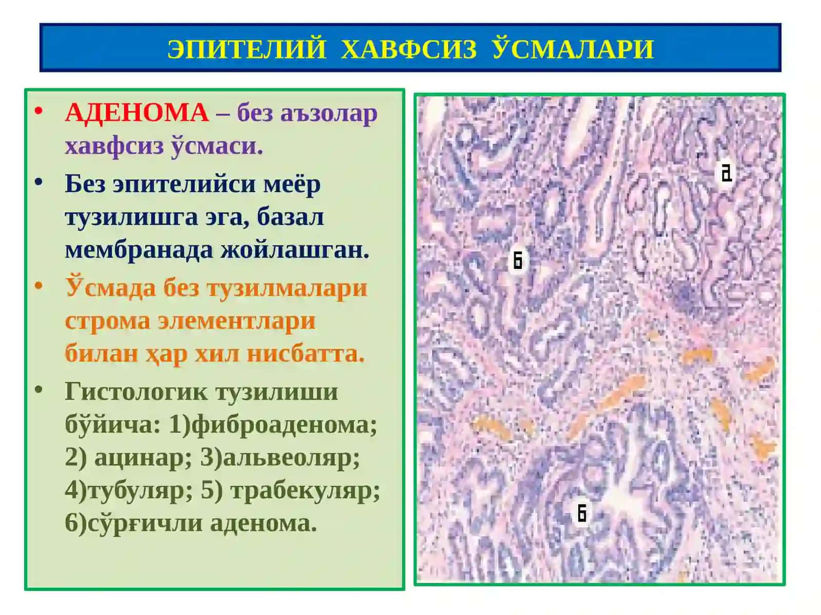 Ўсмалар.Мезенхимал ўсмалар 3