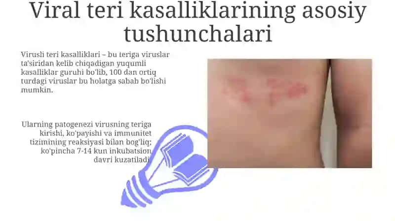 Terining virusli kasalliklari 3