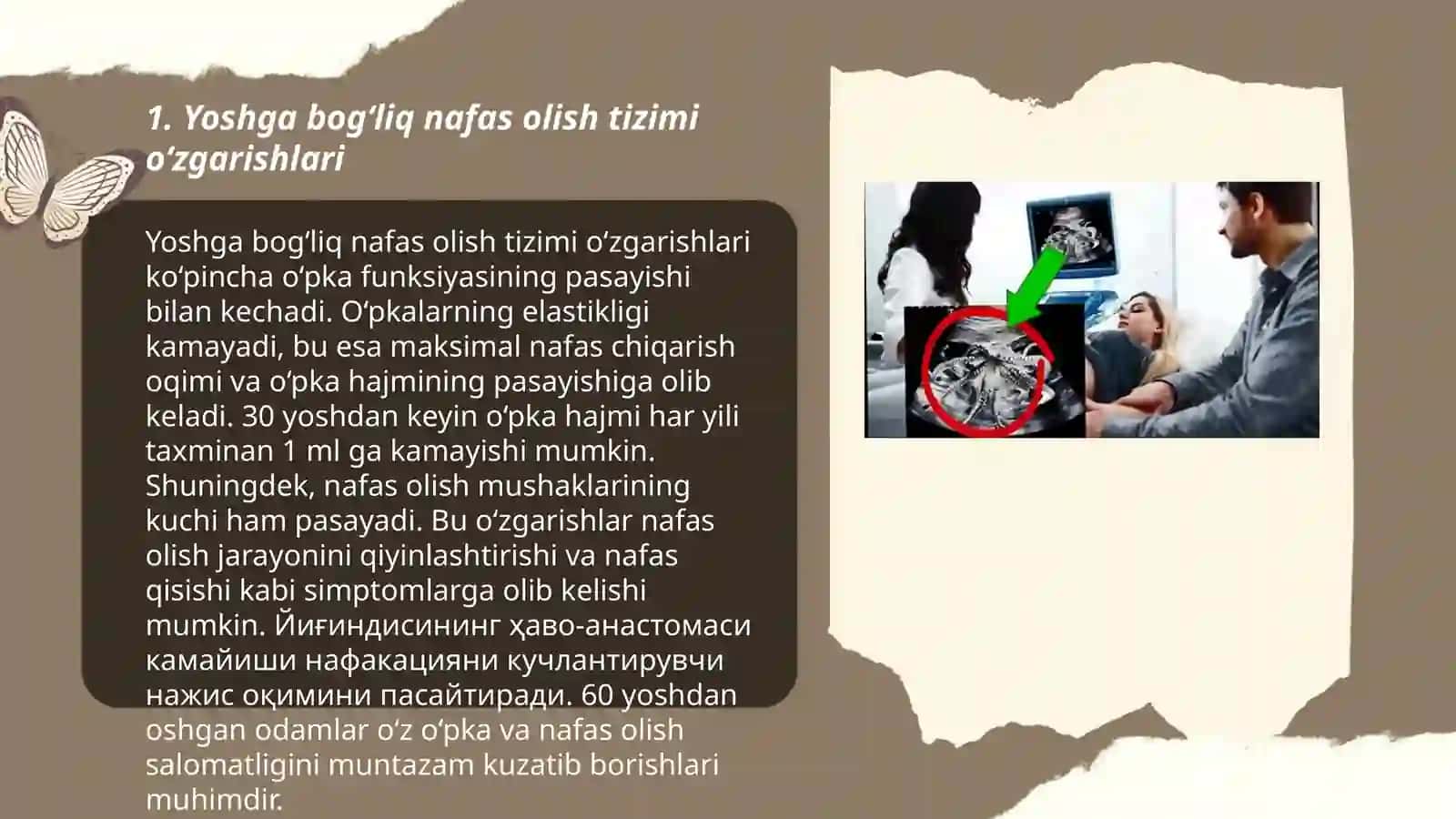 Nafas olish tizimining yoshga bog‘liq xususiyatlari va gigiyenasi 3