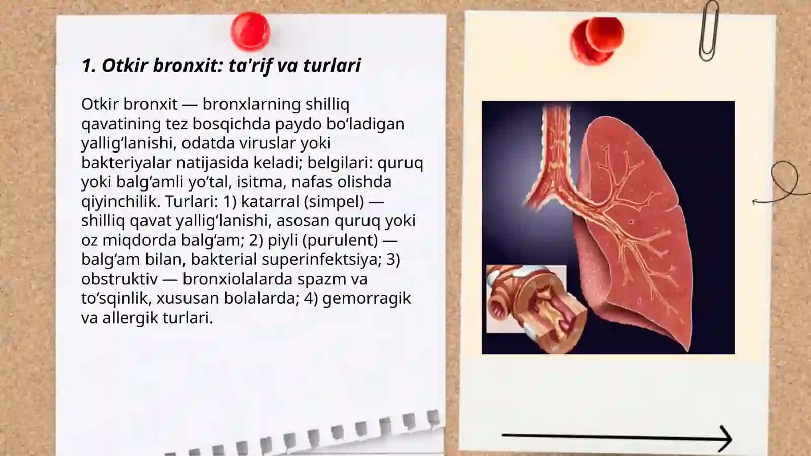 Otkir va surunkali bronxit 3