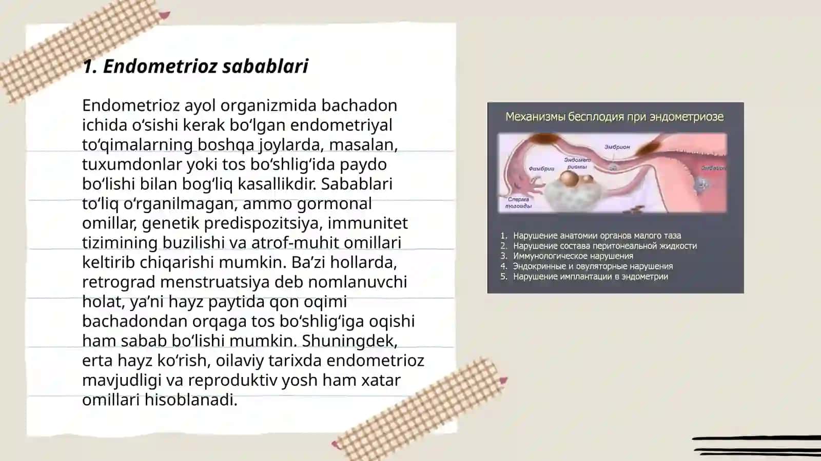 Endometrioz 3