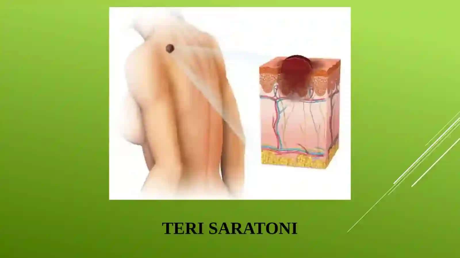 TERI SARATONI 3