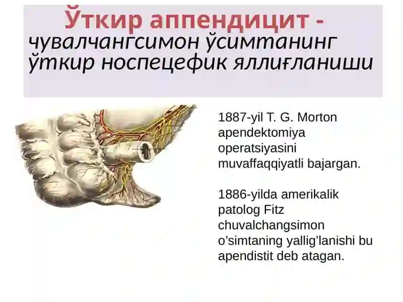 O`tkir appenditsit 3