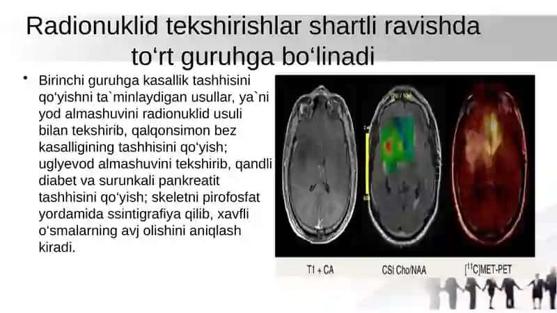 Radioizotop tashxisi 3