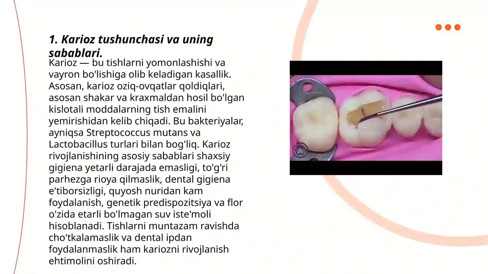 Fantomlarda 1sinf karioz bo’shliqlarini charxlash va plombalash 3
