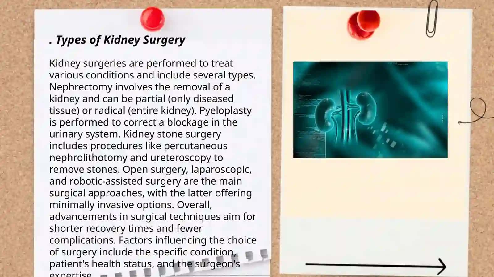 Kidney surgery 3