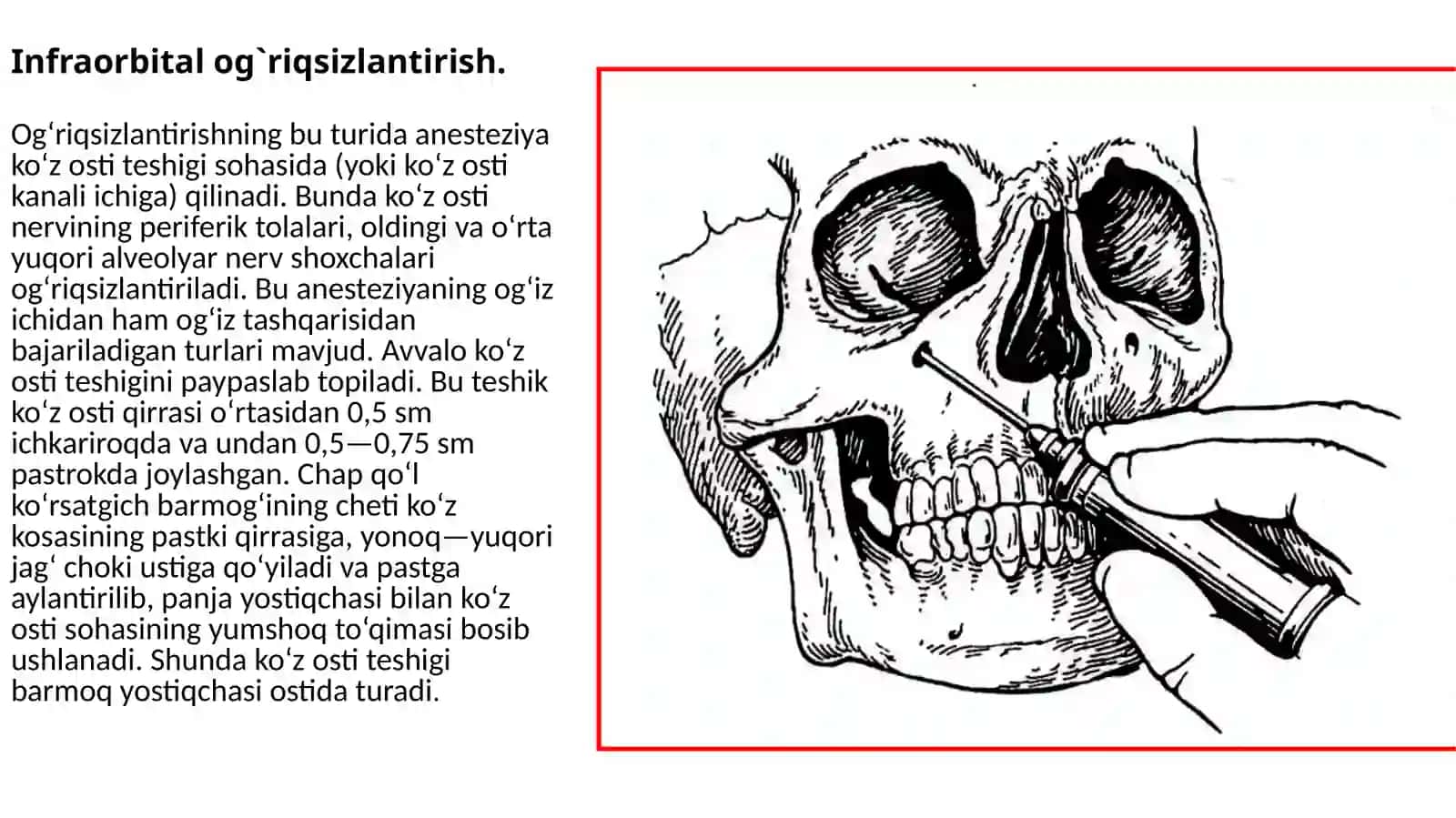 Xirurgik stomatologiya polikilinkasida qo‘llaniladigan og‘riqsizlantirish usullari 3