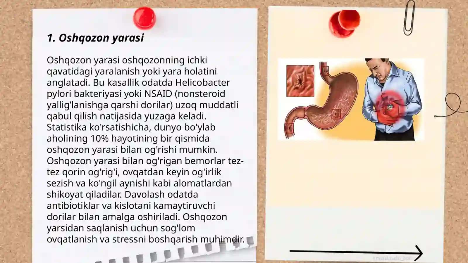 Oshqozon yarasi 3